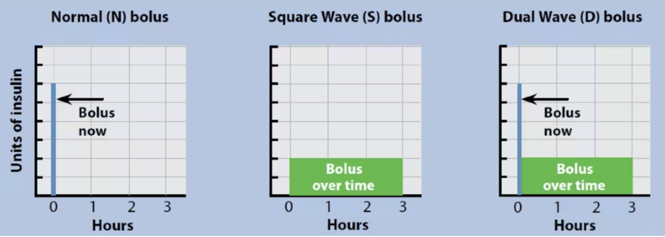 Bolus type chart