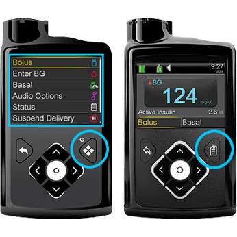 MiniMed 770G and MiniMed™ 630G insulin pumps