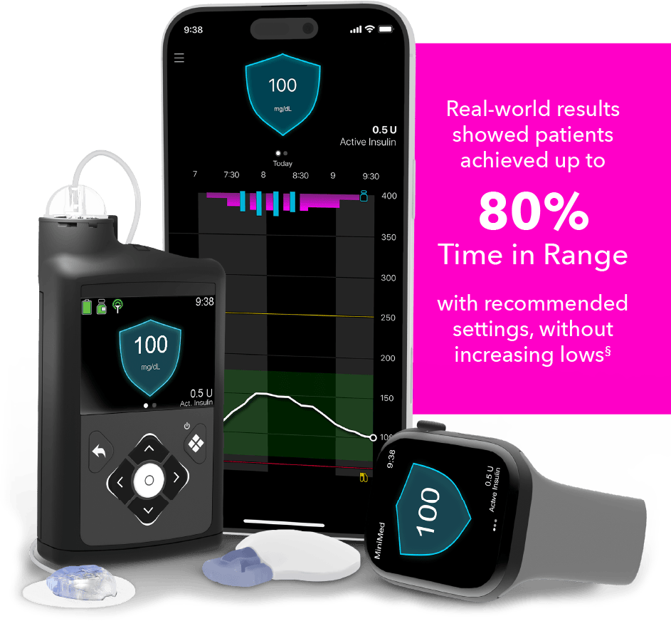 MiniMed™ 780G system with SmartGuard™ technology