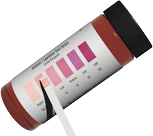 Checking for ketones is an important step in preventing the development of DKA