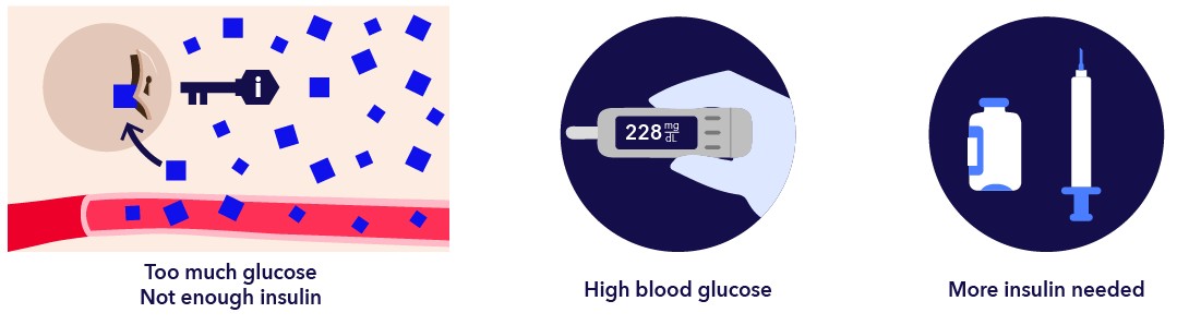Managing Hyperglycemia