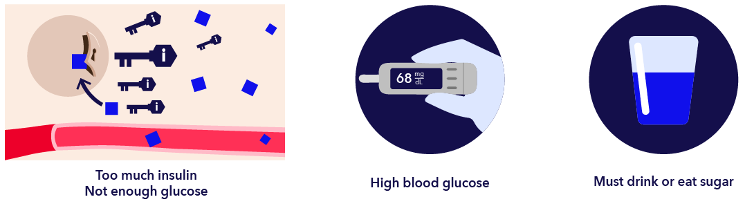 Managing Hypoglycemia