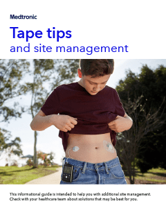 Site management & tape tips
