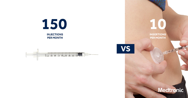 Introducing i-Port Advance™ Injection Port | Medtronic
