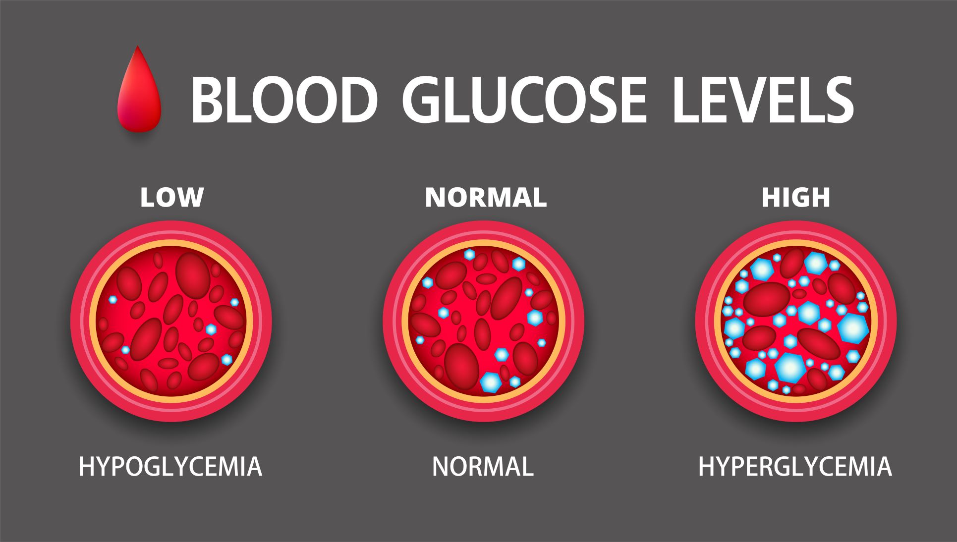 Hyperglycemia vs hypoglycemia